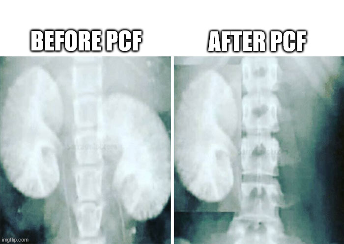 kid pcf.jpg