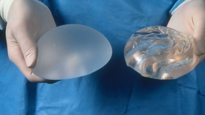 _91929179_c0124133-breast_implants-spl.jpg